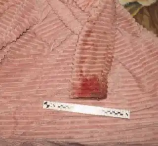 Ревнивая крымчанка напала с ножом на возлюбленного></div>
	<div class=