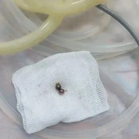 В Севастополе хирурги спасли ребёнка, проглотившего магнитные шарики></div>
	<div class=